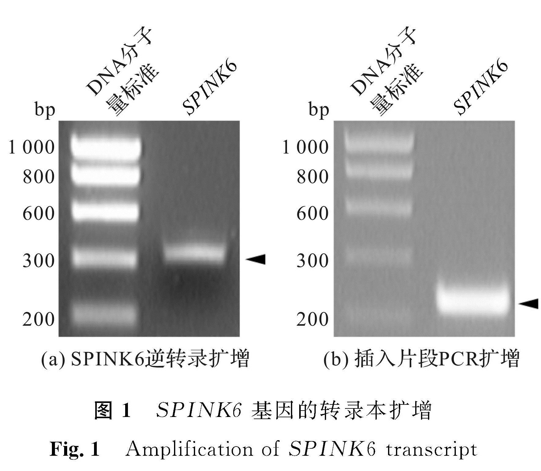 图1 SPINK6基因的转录本扩增<br/>Fig.1 Amplification of SPINK6 transcript