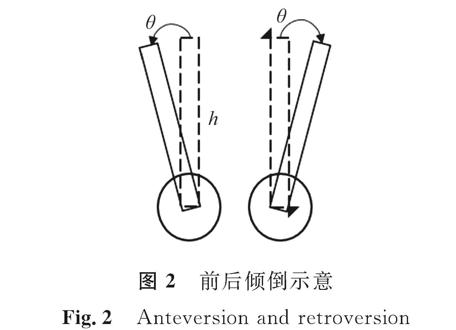 图2 前后倾倒示意<br/>Fig.2 Anteversion and retroversion