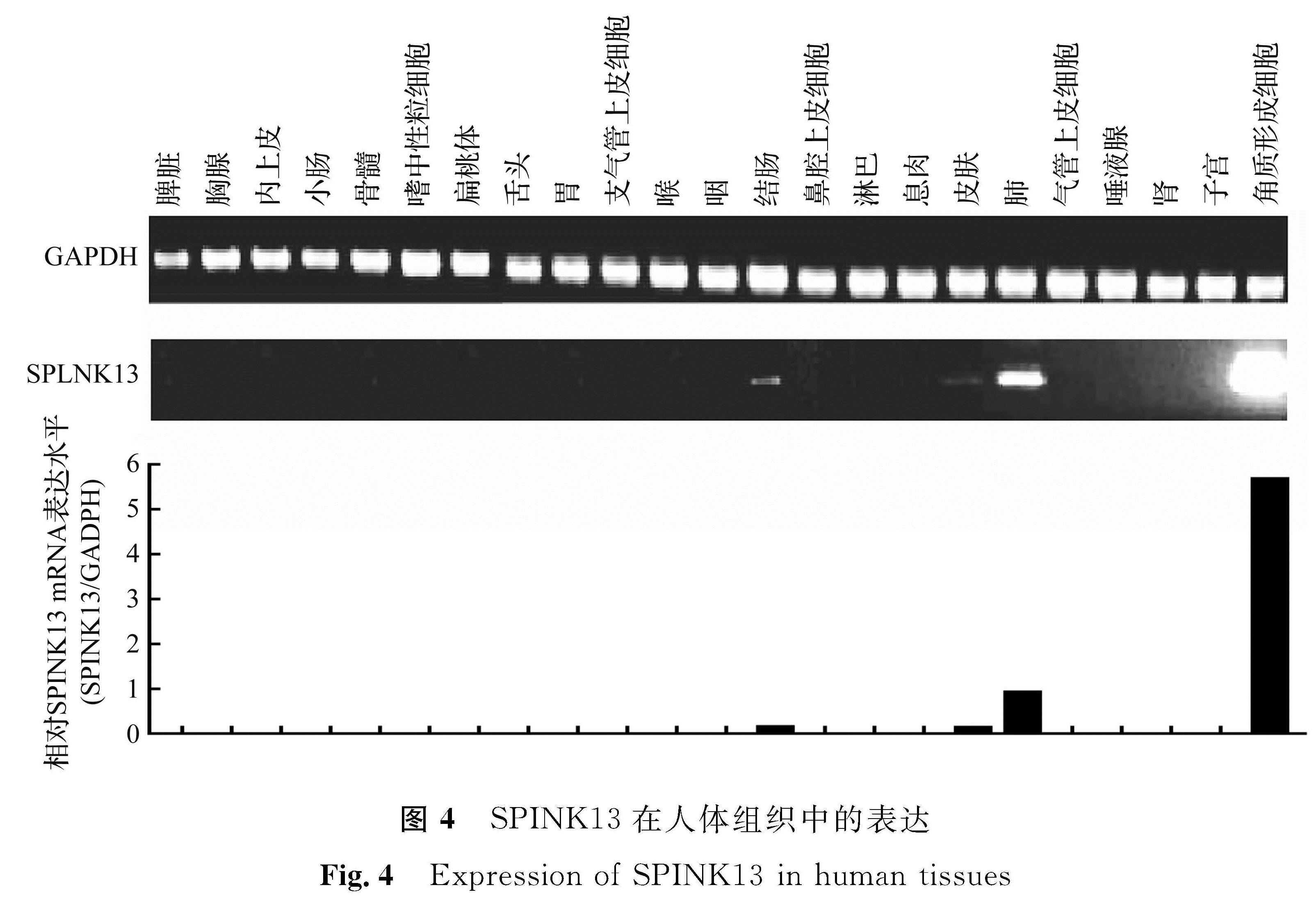 图4 SPINK13在人体组织中的表达<br/>Fig.4 Expression of SPINK13 in human tissues